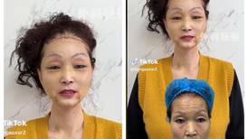 Abuela se vuelve viral tras quedar como quinceañera tras cirugía en el rostro