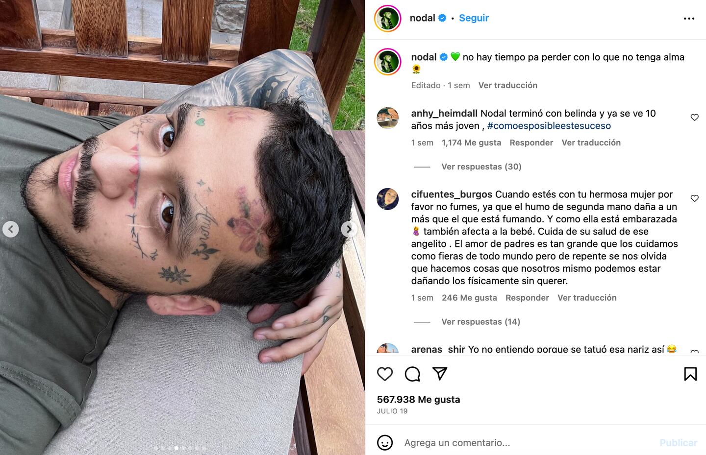 Christian Nodal muestra el cambio de su rostro tras procedimiento de eliminación de tatuajes