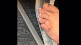 Es viral luego de que circularan imágenes de su pie con seis dedos