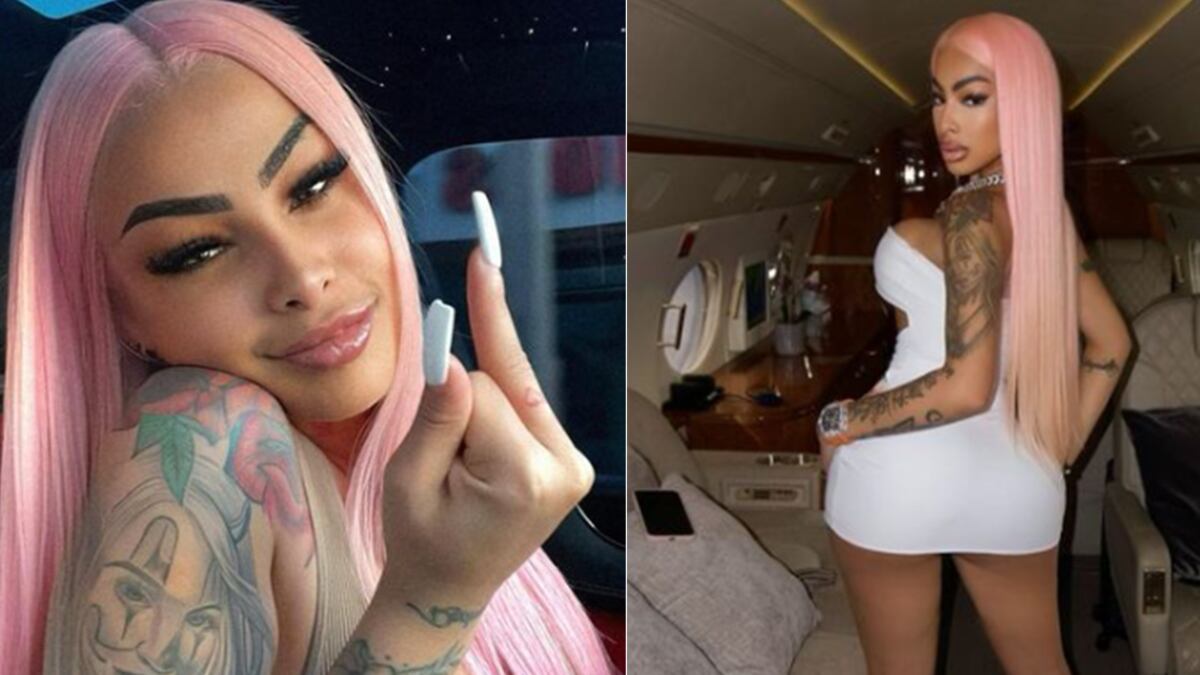 Yailin retoque estético