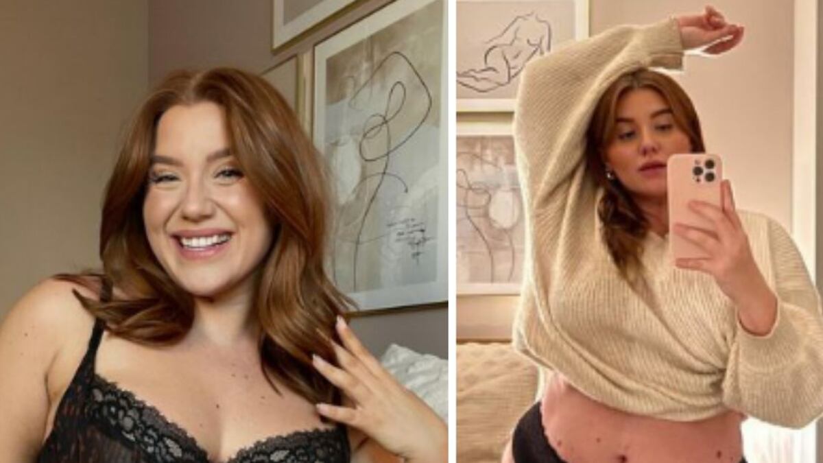 Megan Carole se hizo famosa como modelo plus size que muestra sus estrías con orgullo