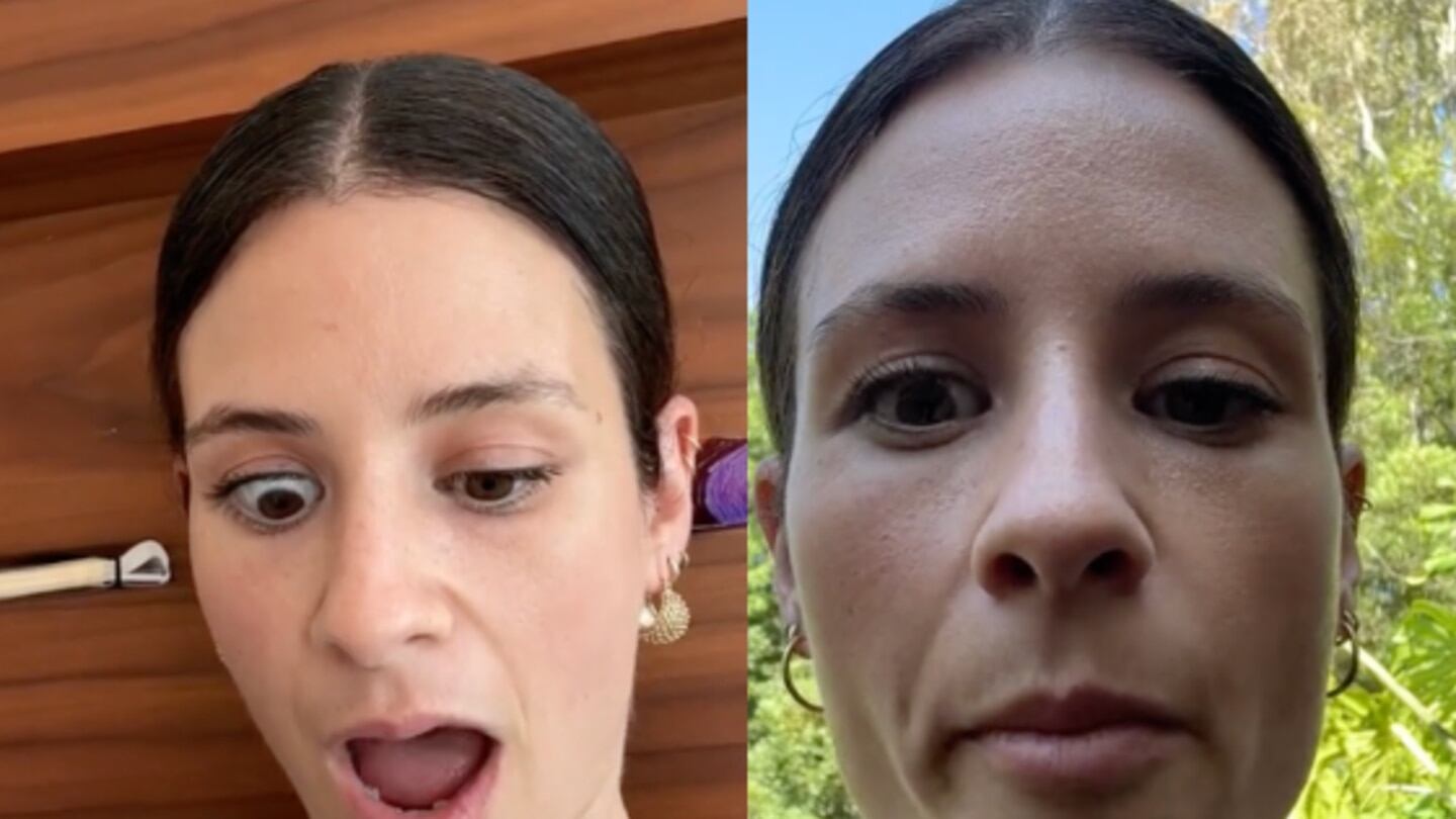 Liana Shaw-Taylor descubrió el nombre de su padecimiento en TikTok.