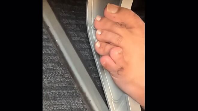 El hombre mostró la condición de su pie sin ningún tipo de complejo