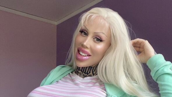 La "Barbie Humana" mostró su antes y después