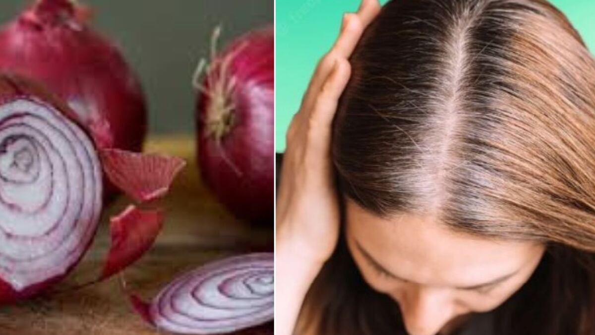 Cebolla para las canas: el remedio natural y casero para eliminarlas