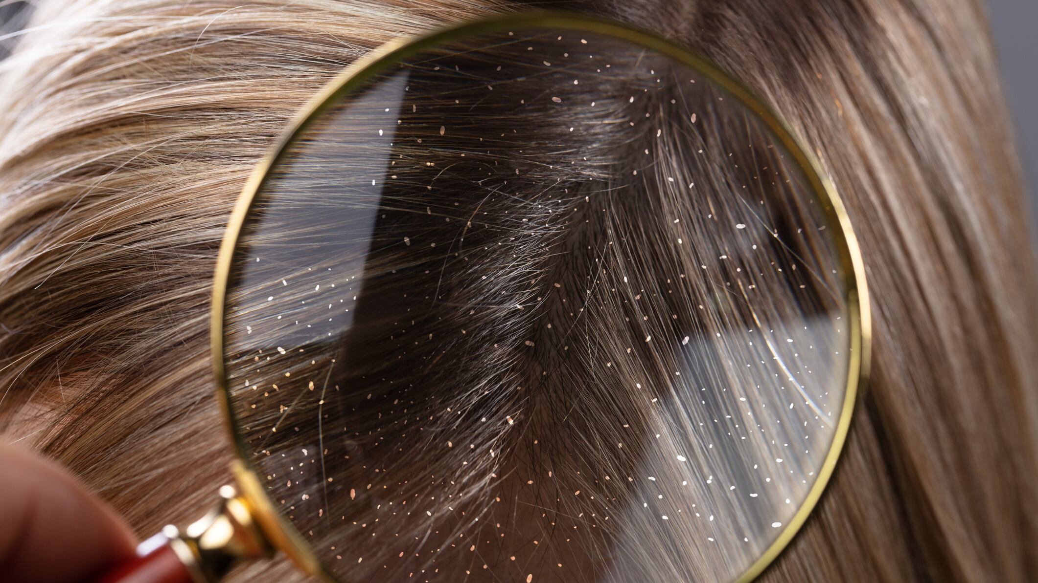 H&S Advanced contra la caspa