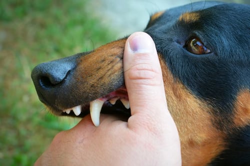 “Solo una madre es tremenda heroína”: mujer cubre con su cuerpo a su hijo para salvarlo del ataque de un perro