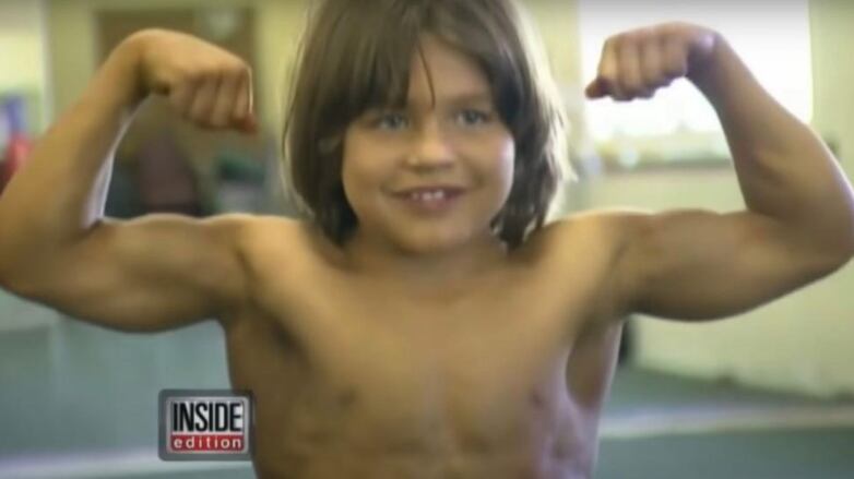 Así lucía el "pequeño Hércules"