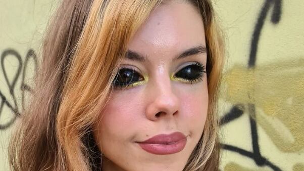 La joven quedó ciega