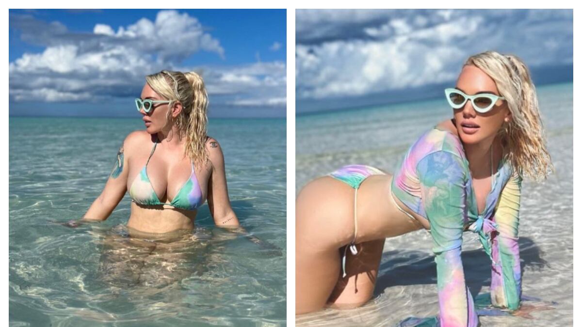 Jennifer Barlow: modelo pierde una pierna en sus vacaciones tras infectarse con bacteria carnívora