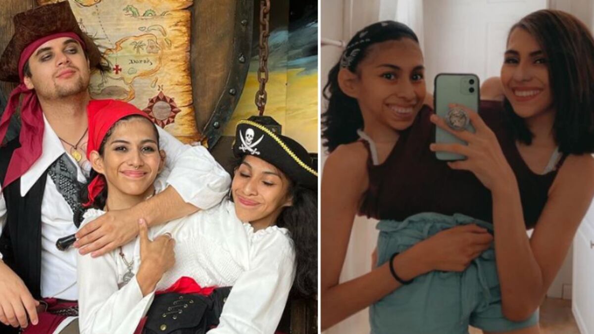 La vida de las siamesas mexicanas que inspira y sorprende a todos
