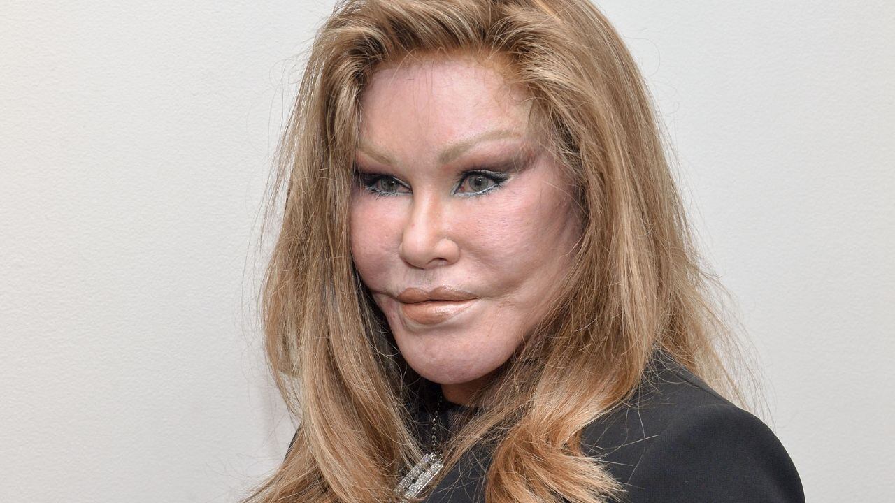 Jocelyn Wildenstein