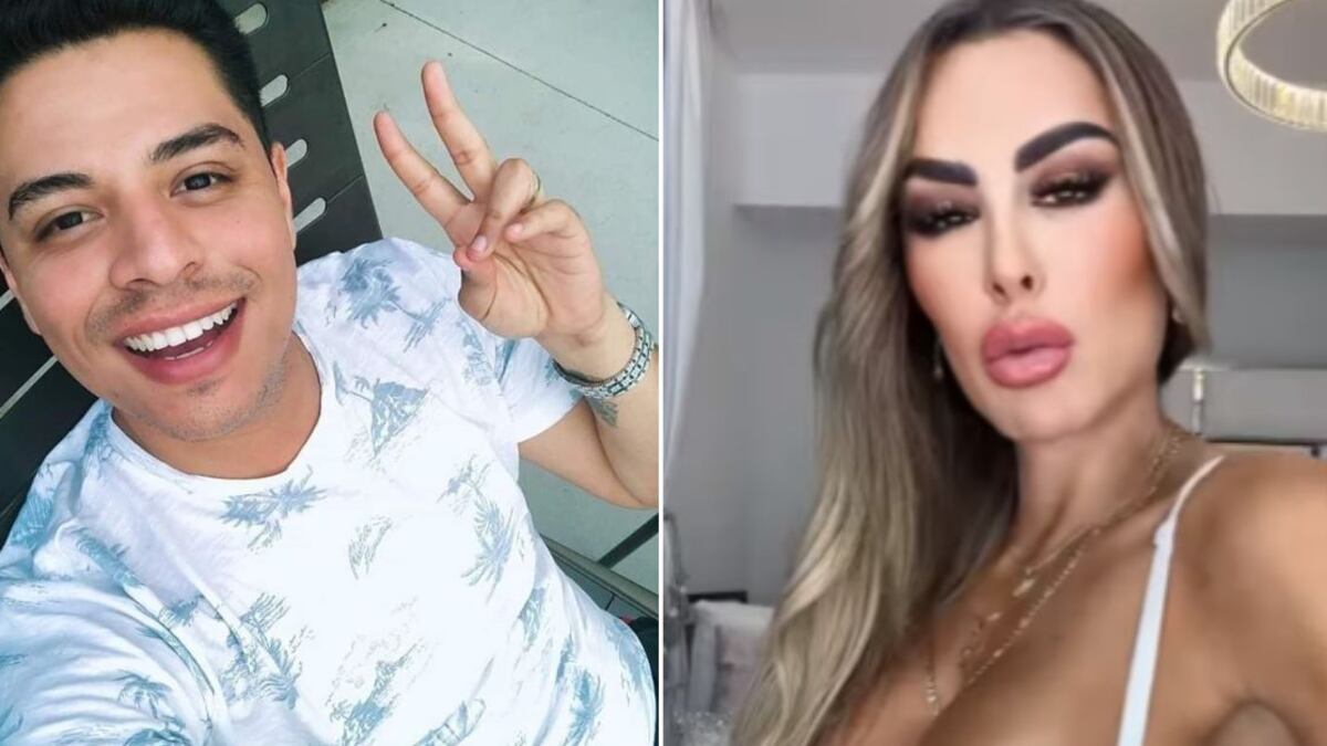 Ninel Conde y Eduin Caz bótox