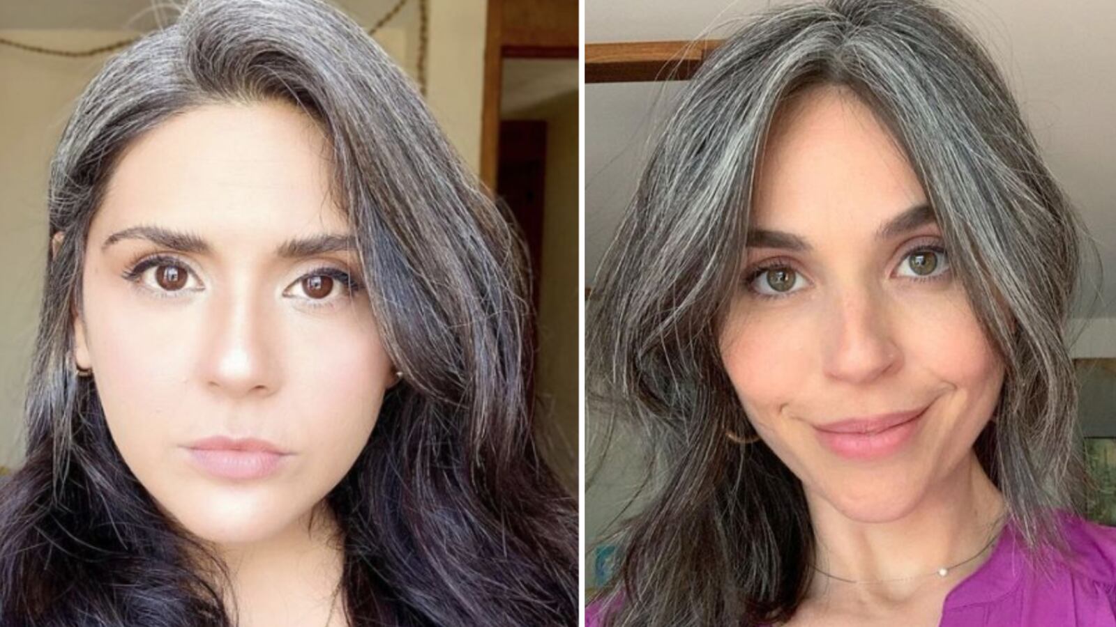 Qué significa la aparición de canas prematuras