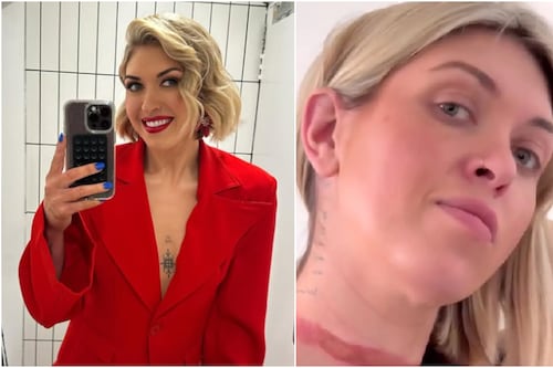 Influencer casi es decapitada por su bufanda en evento y advierte sobre el peligro