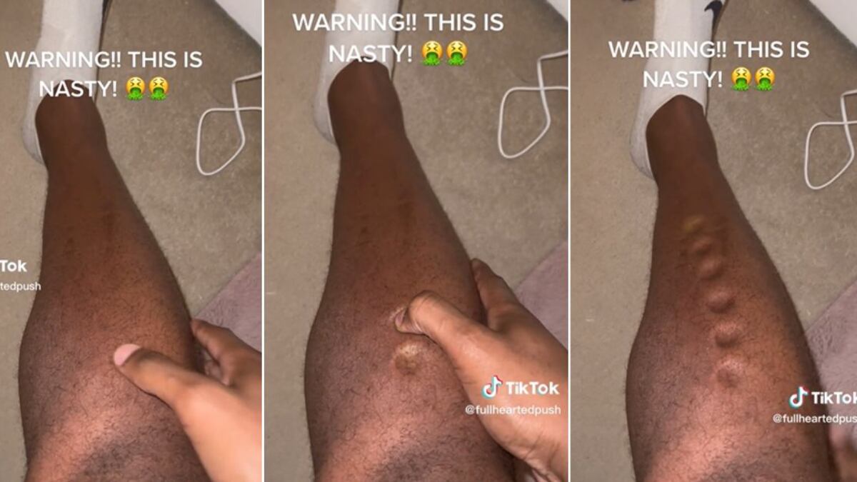 El atleta Lawrence Okoye, grabó un video en el que se ve que su pierna se moldea como una plastilina