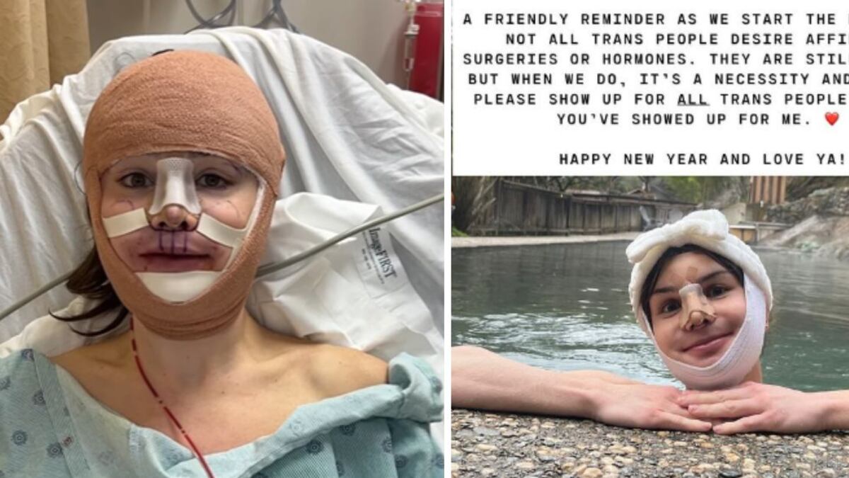 A Dylan Mulvaney, reconocida influencer y activista transgénero, le llegó su momento y recientemente se sometió a una cirugía de feminización